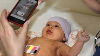 App Turns Your Phone's Camera Into a Jaundice-Detecting Pediatrician